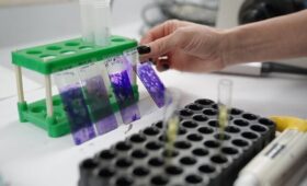 Обнаружен десяток признаков скорости старения крови