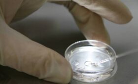 Российские генетики нашли в геноме признаки раннего старения