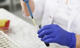 Доктор Мясников призвал сдать один анализ хотя бы раз в жизни