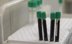 Витамин D изменил ДНК человечества за последние 10 тысяч лет